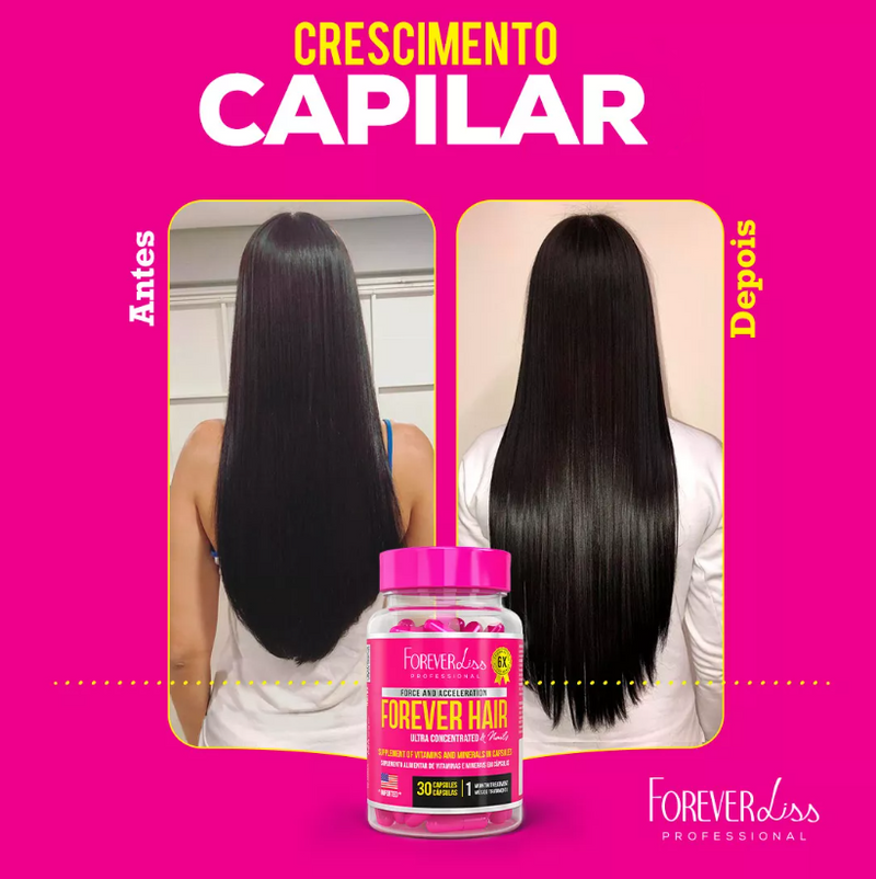 Combo Tratamento  Forever Hair Crescimento Capilar