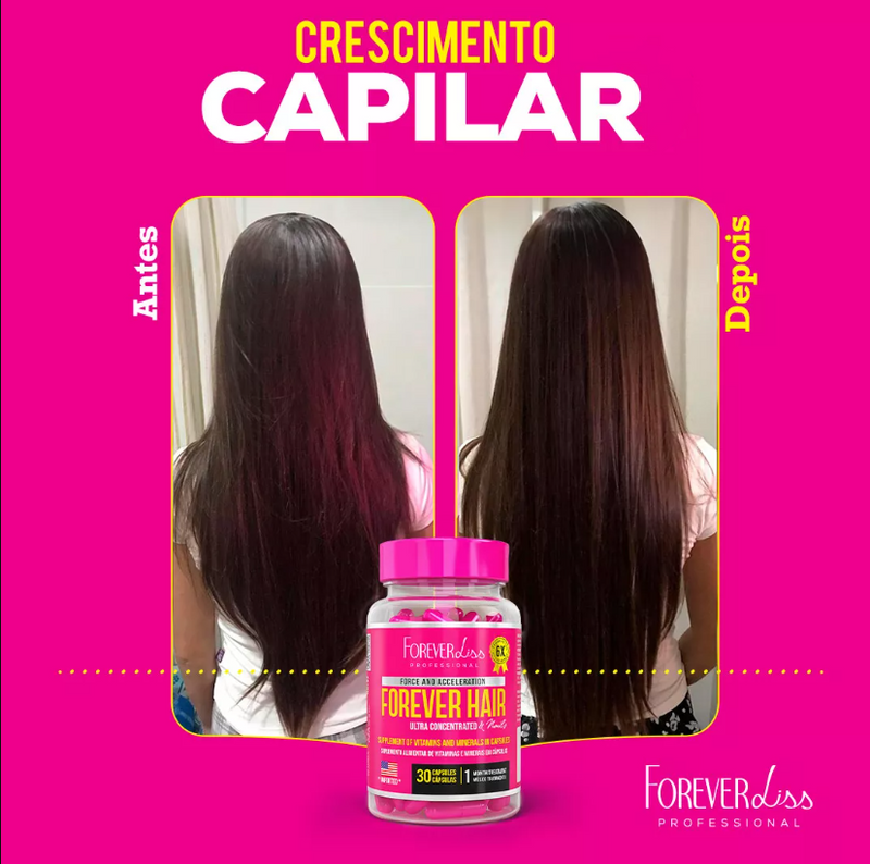 Combo Tratamento  Forever Hair Crescimento Capilar