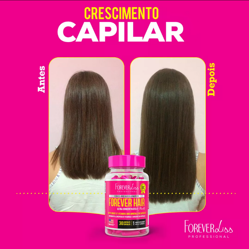 Combo Tratamento  Forever Hair Crescimento Capilar